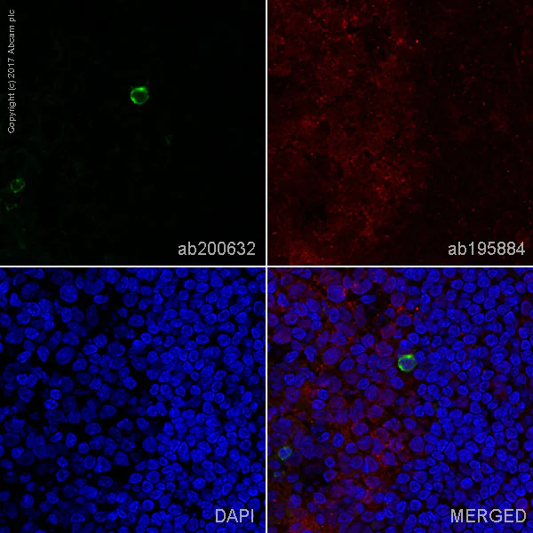 Immunohistochemistry (Frozen sections) - Alexa Fluor® 488 Anti-Human Kappa Chain antibody [EPR11633] (AB200632)