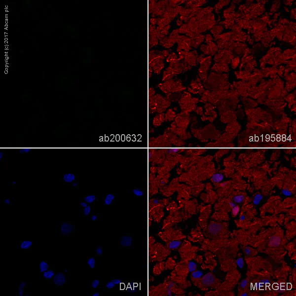 Immunohistochemistry (Frozen sections) - Alexa Fluor® 488 Anti-Human Kappa Chain antibody [EPR11633] (AB200632)