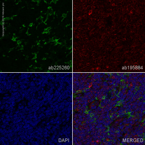 Immunohistochemistry (Formalin/PFA-fixed paraffin-embedded sections) - Alexa Fluor® 488 Anti-Iba1 antibody [EPR16588] - Microglia marker (AB225260)