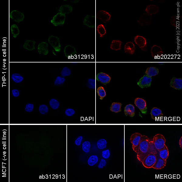 Immunocytochemistry/ Immunofluorescence - Alexa Fluor® 488 Anti-Iba1 antibody [EPR16589] - Mouse IgG1 (Chimeric) (AB312913)