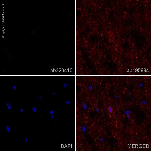 Immunohistochemistry (Frozen sections) - Alexa Fluor® 488 Anti-IgA antibody [EPR5367-76] (AB223410)