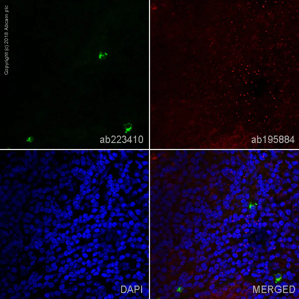 Immunohistochemistry (Frozen sections) - Alexa Fluor® 488 Anti-IgA antibody [EPR5367-76] (AB223410)