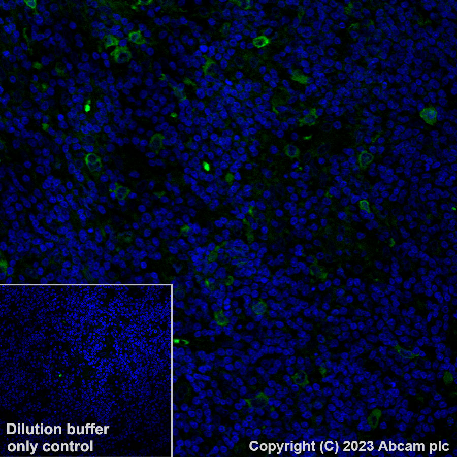 Immunohistochemistry (Formalin/PFA-fixed paraffin-embedded sections) - Alexa Fluor® 488 Anti-IGF2BP1/IMP1 antibody [EPR18791] (AB315421), expandable thumbnail