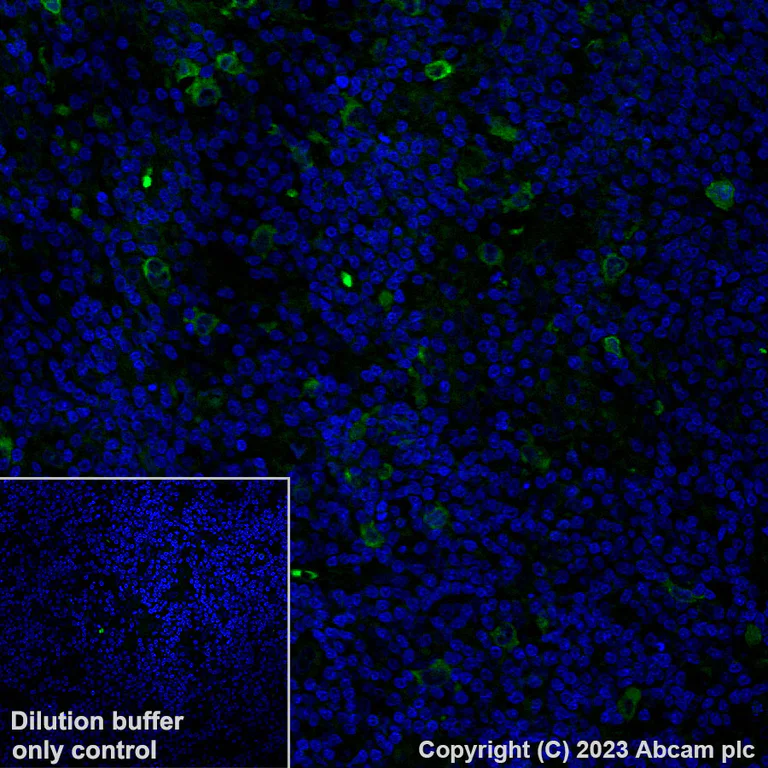Immunohistochemistry (Formalin/PFA-fixed paraffin-embedded sections) - Alexa Fluor® 488 Anti-IGF2BP1/IMP1 antibody [EPR18791] (AB315421)