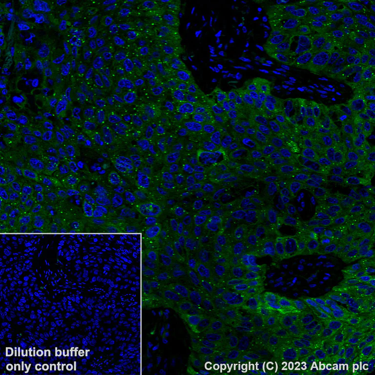 Immunohistochemistry (Formalin/PFA-fixed paraffin-embedded sections) - Alexa Fluor® 488 Anti-IGF2BP1/IMP1 antibody [EPR18791] (AB315421)