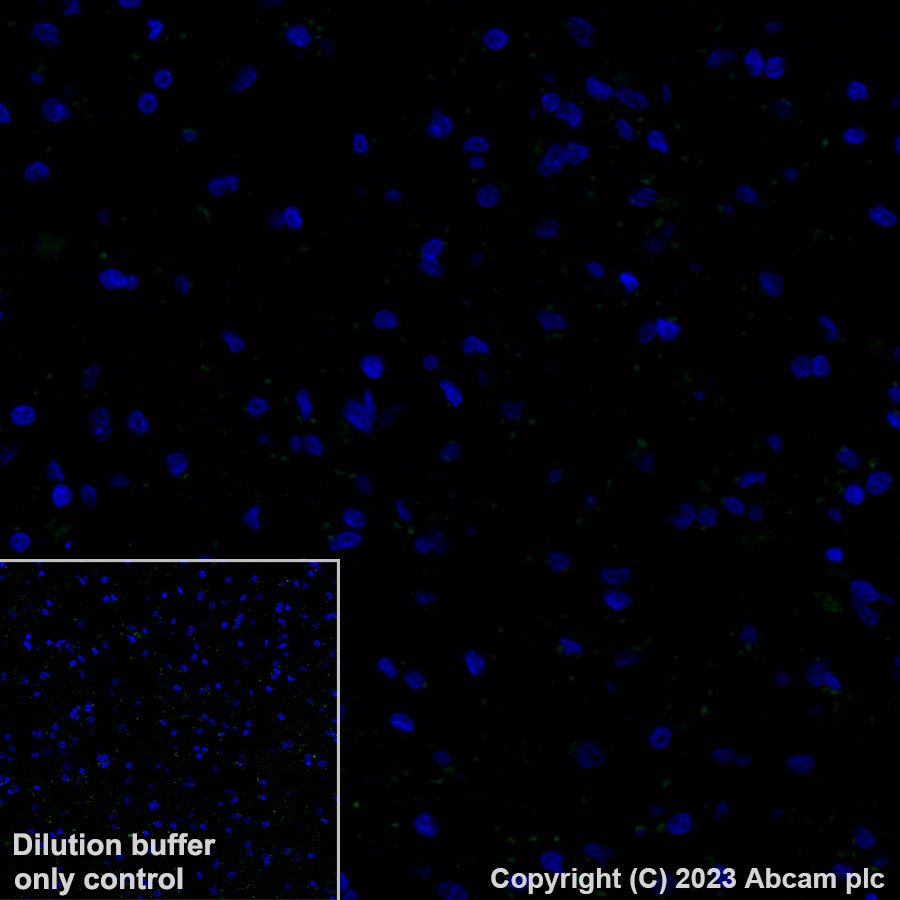 Immunohistochemistry (Formalin/PFA-fixed paraffin-embedded sections) - Alexa Fluor® 488 Anti-IGF2BP1/IMP1 antibody [EPR18791] (AB315421), expandable thumbnail
