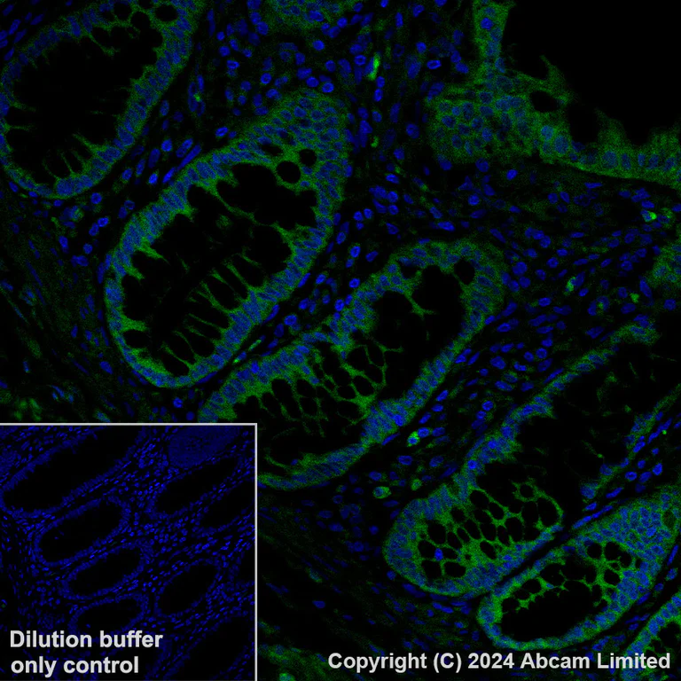 Immunohistochemistry (Formalin/PFA-fixed paraffin-embedded sections) - Alexa Fluor® 488 Anti-IGF2BP2/IMP-2 antibody [EPR6741(B)] (AB319129)