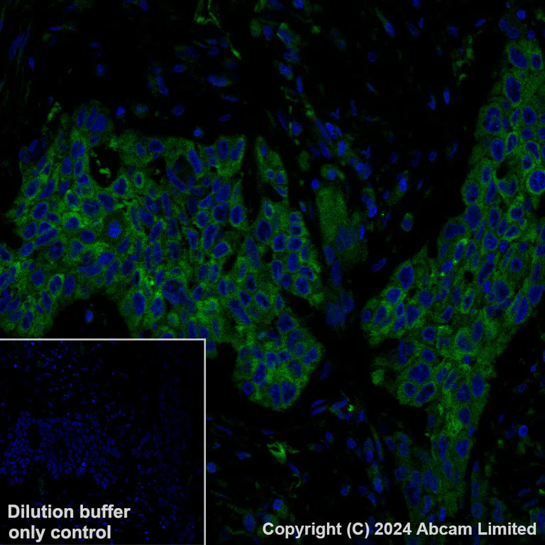 Immunohistochemistry (Formalin/PFA-fixed paraffin-embedded sections) - Alexa Fluor® 488 Anti-IGF2BP2/IMP-2 antibody [EPR6741(B)] (AB319129)