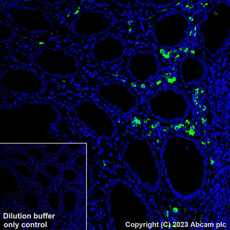 Immunohistochemistry (Formalin/PFA-fixed paraffin-embedded sections) - Alexa Fluor® 488 Anti-IgG2 antibody [EPR4418] (AB313754)