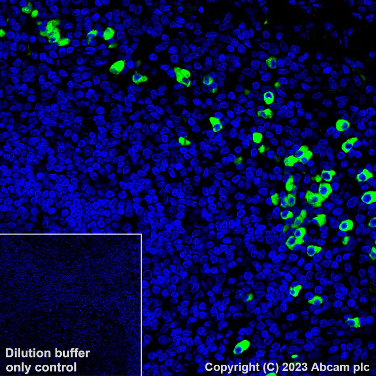 Immunohistochemistry (Formalin/PFA-fixed paraffin-embedded sections) - Alexa Fluor® 488 Anti-IgG2 antibody [EPR4418] (AB313754)