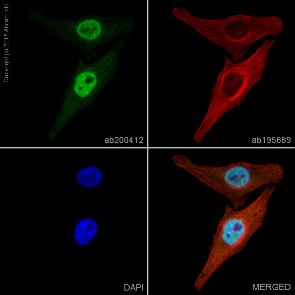 Immunocytochemistry/ Immunofluorescence - Alexa Fluor® 488 Anti-IKK alpha antibody [Y463] (AB200412), expandable thumbnail