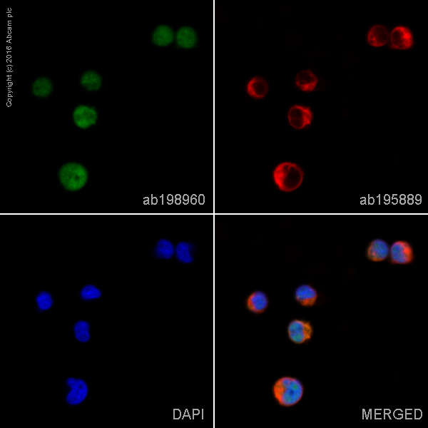 Immunocytochemistry/ Immunofluorescence - Alexa Fluor® 488 Anti-IKZF3 antibody [EPR9342(B)] (AB198960)