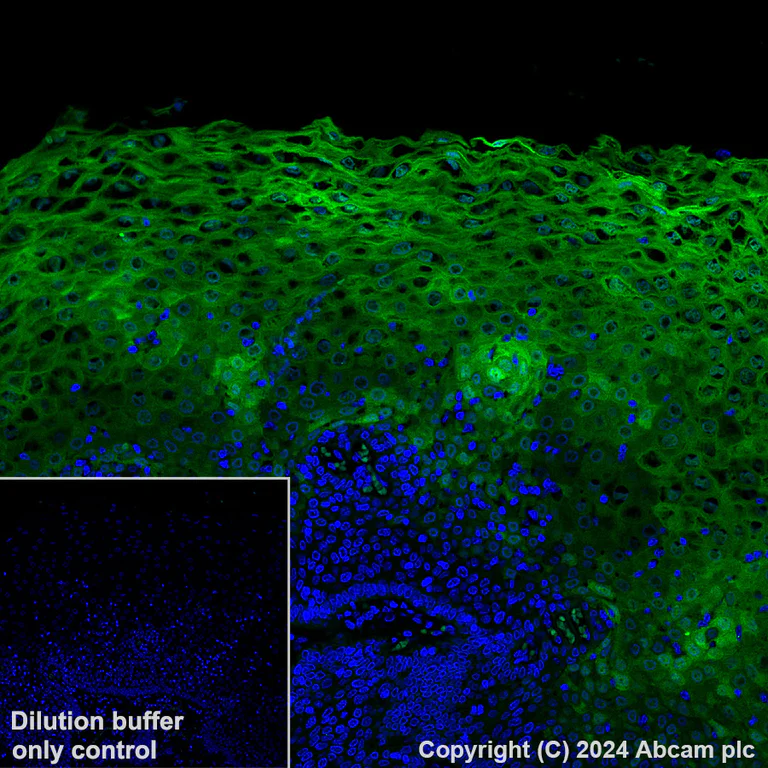 Immunohistochemistry (Formalin/PFA-fixed paraffin-embedded sections) - Alexa Fluor® 488 Anti-IL-1RA antibody [EPR26853-58] (AB317288)