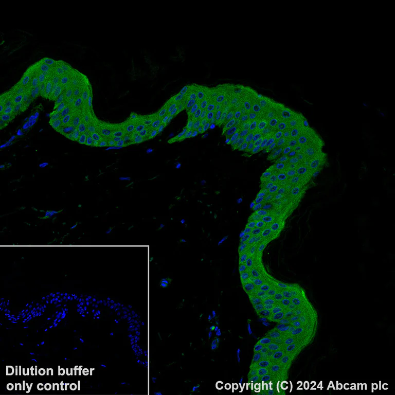 Immunohistochemistry (Formalin/PFA-fixed paraffin-embedded sections) - Alexa Fluor® 488 Anti-IL-1RA antibody [EPR26853-58] (AB317288)
