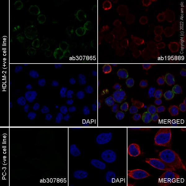 Immunocytochemistry/ Immunofluorescence - Alexa Fluor® 488 Anti-IL-2 Receptor alpha antibody [EPR6452] (AB307865), expandable thumbnail