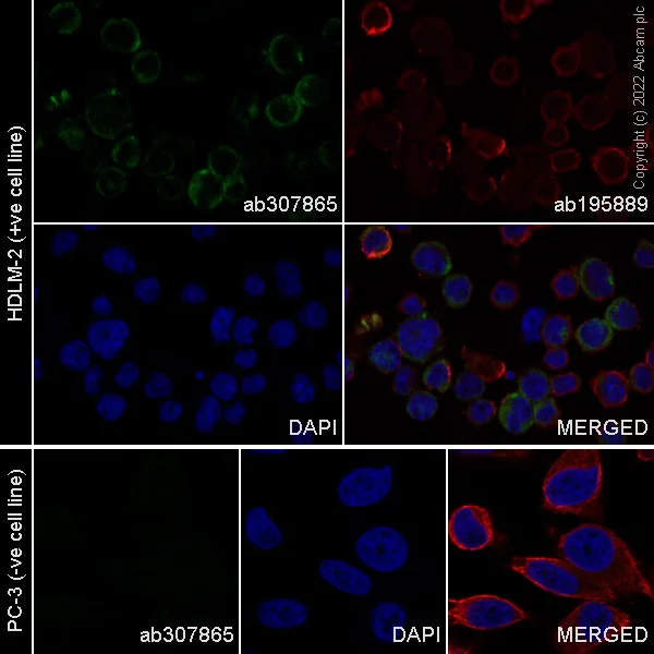 Immunocytochemistry/ Immunofluorescence - Alexa Fluor® 488 Anti-IL-2 Receptor alpha antibody [EPR6452] (AB307865)