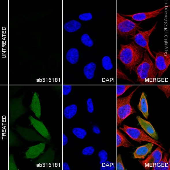Immunocytochemistry/ Immunofluorescence - Alexa Fluor® 488 Anti-Indoleamine 2, 3-dioxygenase antibody [EPR20374] (AB315181)