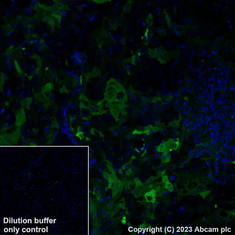 Immunohistochemistry (Formalin/PFA-fixed paraffin-embedded sections) - Alexa Fluor® 488 Anti-Indoleamine 2, 3-dioxygenase antibody [EPR20374] (AB315181)