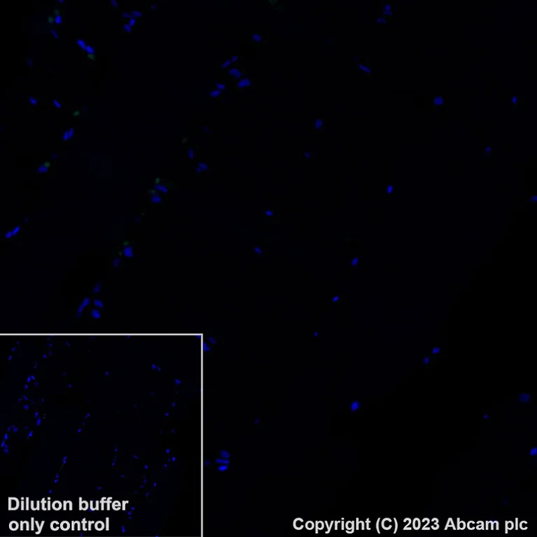 Immunohistochemistry (Formalin/PFA-fixed paraffin-embedded sections) - Alexa Fluor® 488 Anti-Indoleamine 2, 3-dioxygenase antibody [EPR20374] (AB315181)