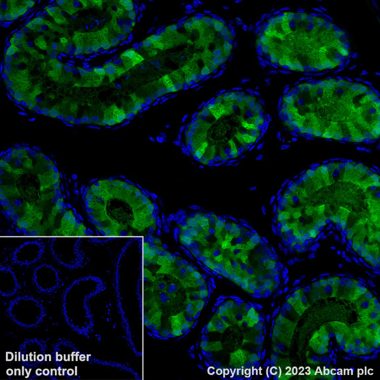 Immunohistochemistry (Formalin/PFA-fixed paraffin-embedded sections) - Alexa Fluor® 488 Anti-Indoleamine 2, 3-dioxygenase antibody [EPR28349-89] (AB317667)