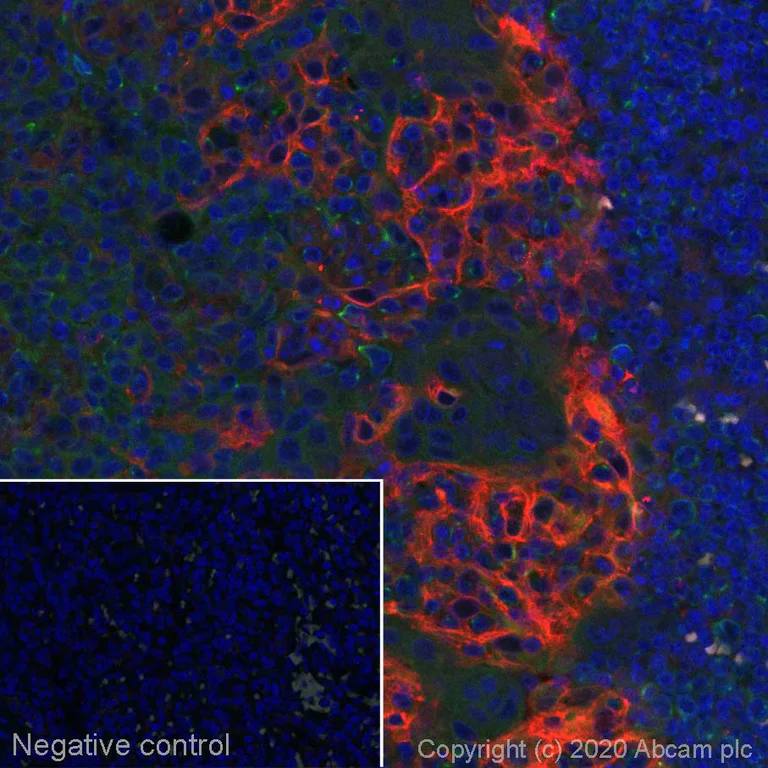 Immunohistochemistry (Formalin/PFA-fixed paraffin-embedded sections) - Alexa Fluor® 488 Anti-Integrin alpha V antibody [EPR16800] (AB275350)