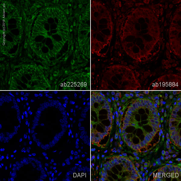 Immunohistochemistry (Formalin/PFA-fixed paraffin-embedded sections) - Alexa Fluor® 488 Anti-Integrin beta 1 antibody [EPR16895] (AB225269), expandable thumbnail