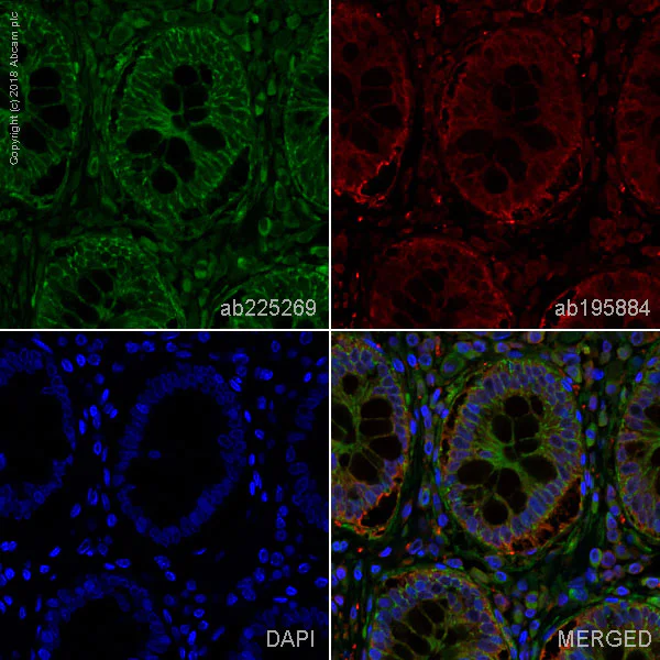 Immunohistochemistry (Formalin/PFA-fixed paraffin-embedded sections) - Alexa Fluor® 488 Anti-Integrin beta 1 antibody [EPR16895] (AB225269)