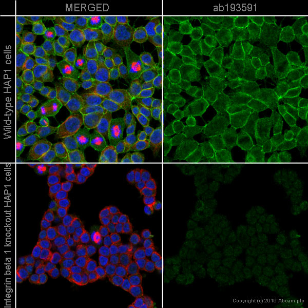 Immunocytochemistry/ Immunofluorescence - Alexa Fluor® 488 Anti-Integrin beta 1 antibody [P5D2] (AB193591), expandable thumbnail