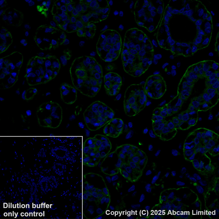 Immunohistochemistry (Formalin/PFA-fixed paraffin-embedded sections) - Alexa Fluor® 488 Anti-Integrin beta 4 antibody [EPR17517] (AB323999), expandable thumbnail