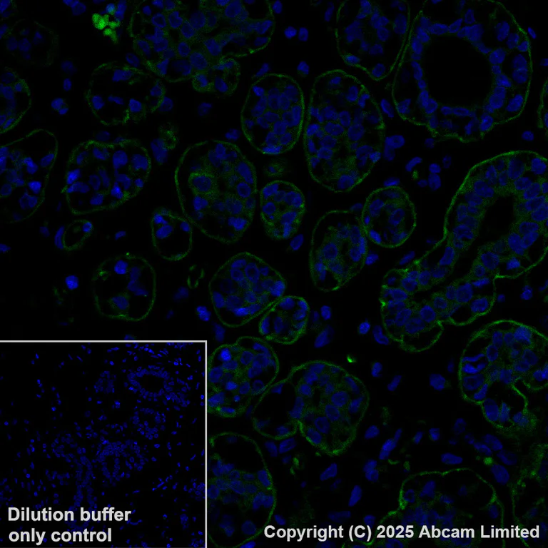 Immunohistochemistry (Formalin/PFA-fixed paraffin-embedded sections) - Alexa Fluor® 488 Anti-Integrin beta 4 antibody [EPR17517] (AB323999)