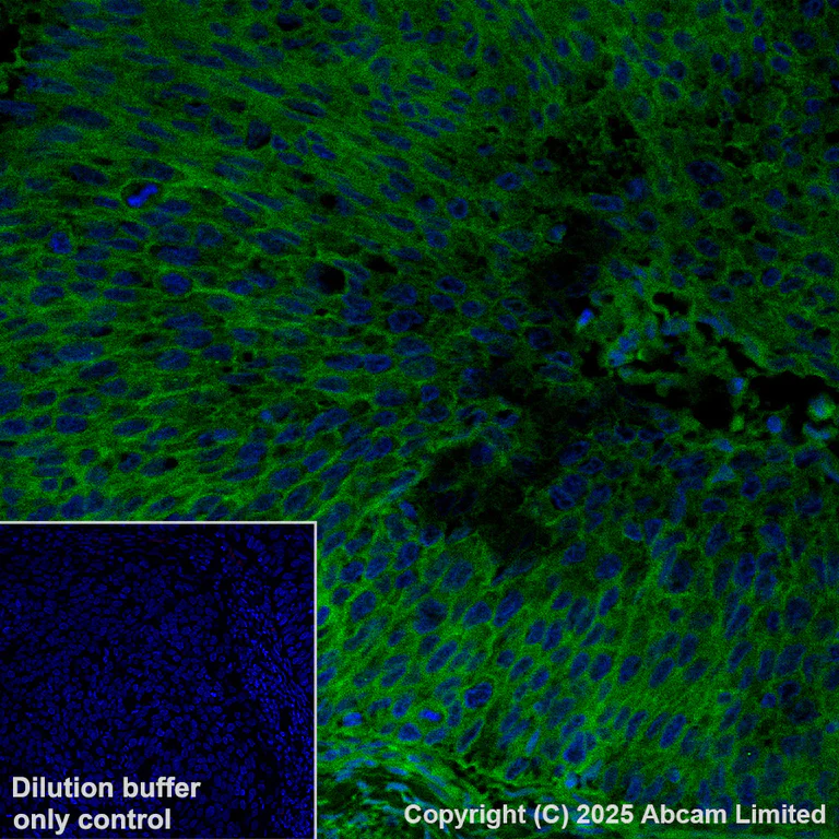 Immunohistochemistry (Formalin/PFA-fixed paraffin-embedded sections) - Alexa Fluor® 488 Anti-Integrin beta 4 antibody [EPR17517] (AB323999)