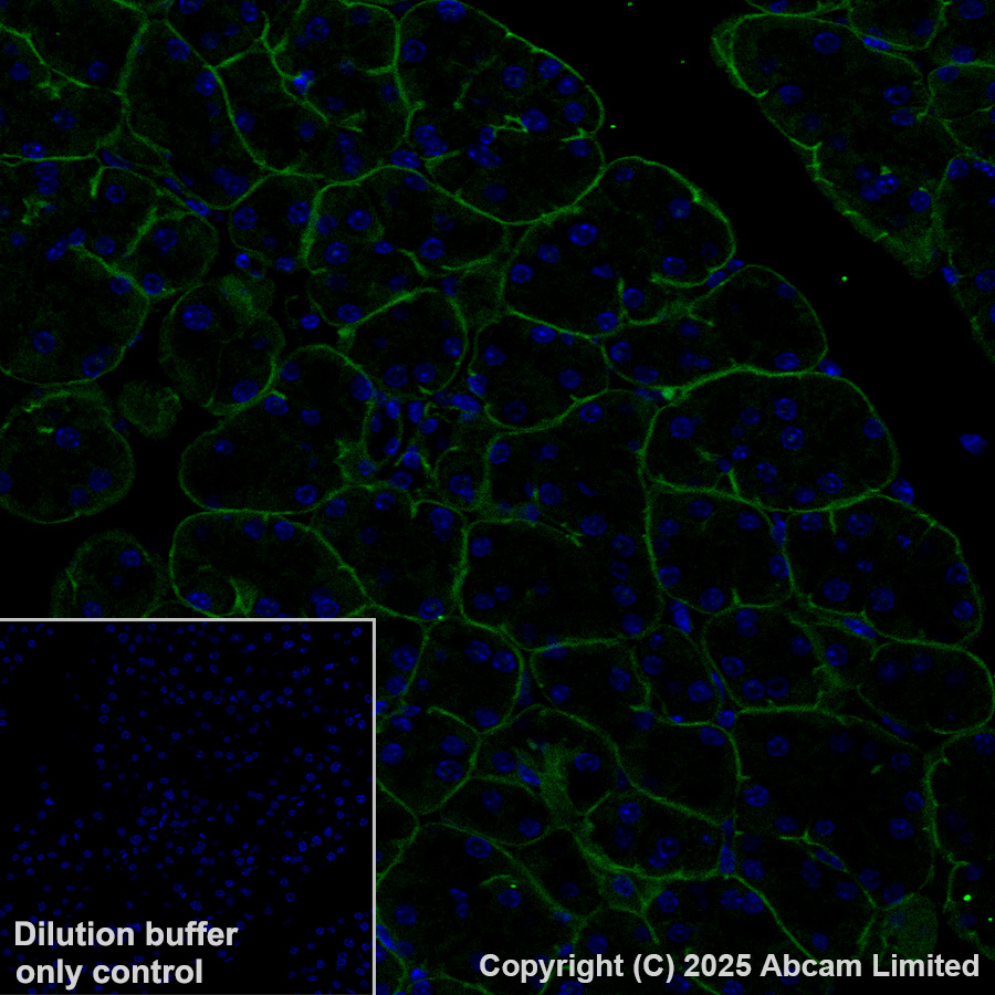 Immunohistochemistry (Formalin/PFA-fixed paraffin-embedded sections) - Alexa Fluor® 488 Anti-Integrin beta 4 antibody [EPR17517] (AB323999), expandable thumbnail