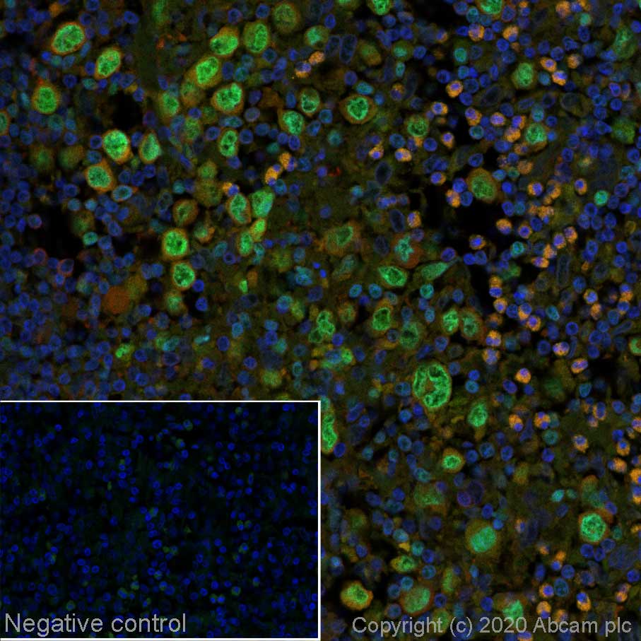Immunohistochemistry (Formalin/PFA-fixed paraffin-embedded sections) - Alexa Fluor® 488 Anti-IRF4 antibody [EP5699] (AB252023)