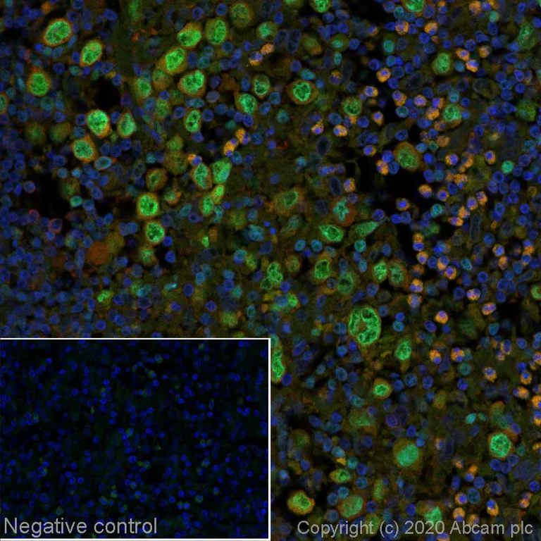 Immunohistochemistry (Formalin/PFA-fixed paraffin-embedded sections) - Alexa Fluor® 488 Anti-IRF4 antibody [EP5699] (AB252023)