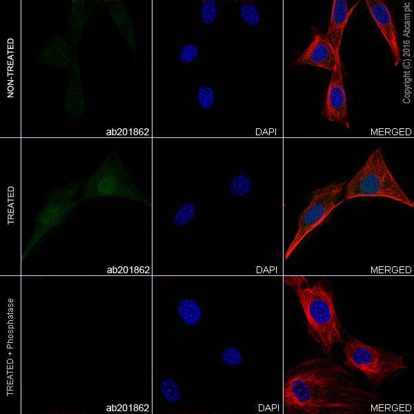 Immunocytochemistry/ Immunofluorescence - Alexa Fluor® 488 Anti-JNK1 + JNK2 + JNK3 (phospho T183+T183+T221) antibody [EPR5693] (AB201862), expandable thumbnail