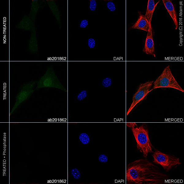 Immunocytochemistry/ Immunofluorescence - Alexa Fluor® 488 Anti-JNK1 + JNK2 + JNK3 (phospho T183+T183+T221) antibody [EPR5693] (AB201862)