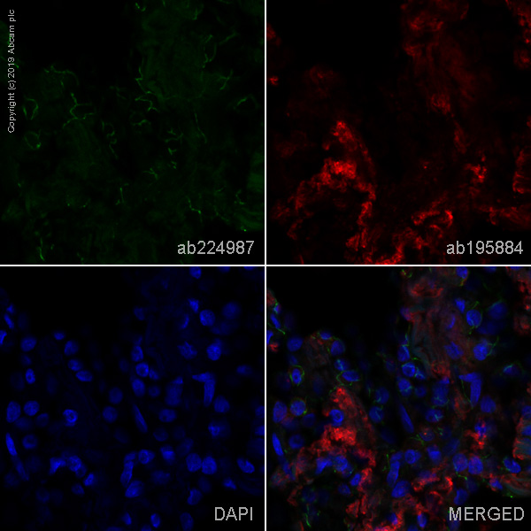 Immunohistochemistry (Formalin/PFA-fixed paraffin-embedded sections) - Alexa Fluor® 488 Anti-Junctional Adhesion Molecule 1/JAM-A antibody [EP1042Y] (AB224987)