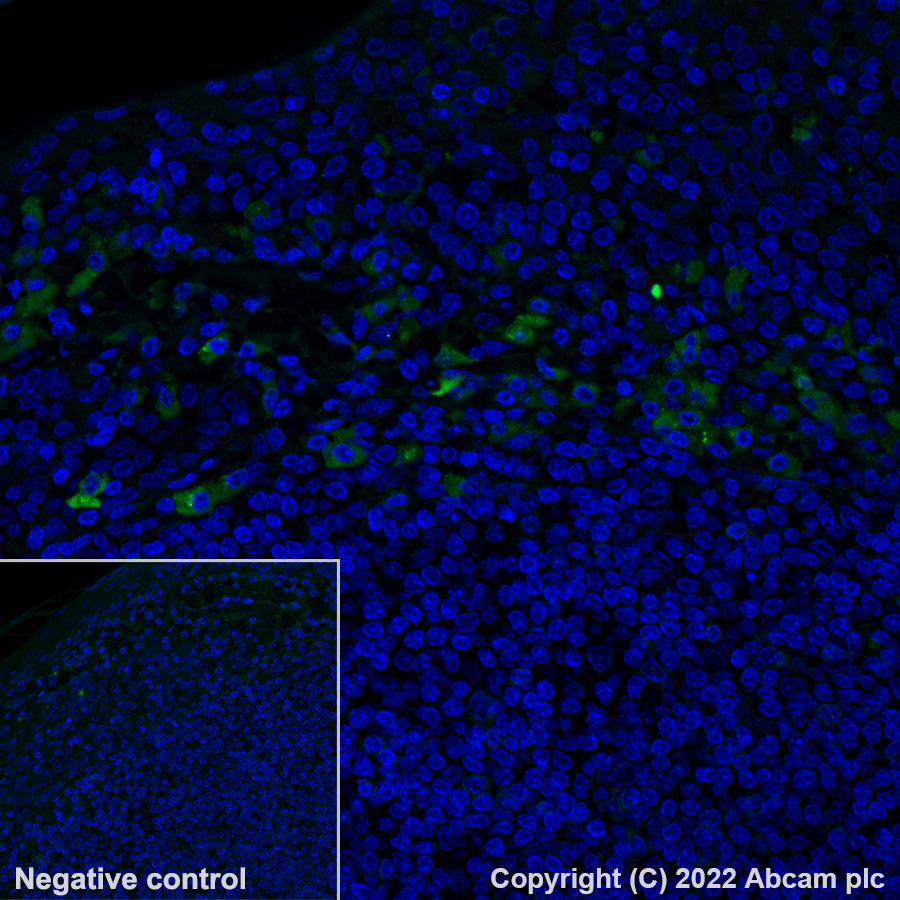 Immunohistochemistry (Formalin/PFA-fixed paraffin-embedded sections) - Alexa Fluor® 488 Anti-Kappa light chain antibody [EPR5367-8] (AB300547), expandable thumbnail