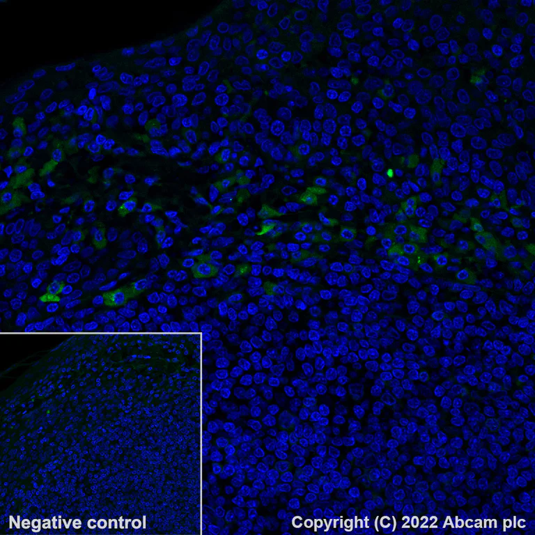 Immunohistochemistry (Formalin/PFA-fixed paraffin-embedded sections) - Alexa Fluor® 488 Anti-Kappa light chain antibody [EPR5367-8] (AB300547)