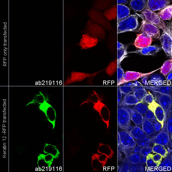 Immunocytochemistry/ Immunofluorescence - Alexa Fluor® 488 Anti-Keratin 12/K12 antibody [EPR17882] (AB222116)