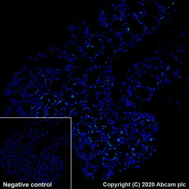 Immunohistochemistry (Formalin/PFA-fixed paraffin-embedded sections) - Alexa Fluor® 488 Anti-Ki67 antibody [SP6] (AB281847)