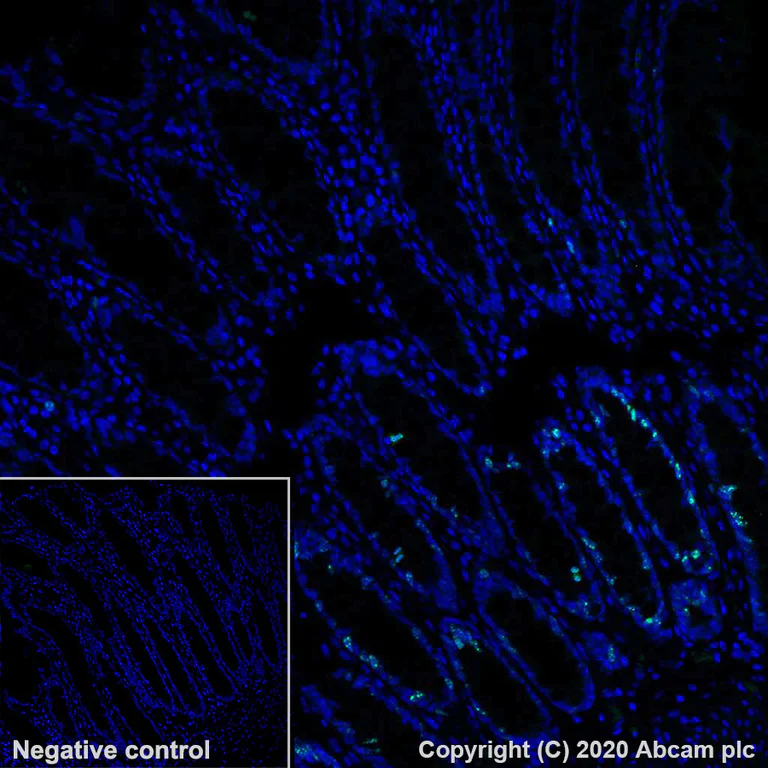 Immunohistochemistry (Formalin/PFA-fixed paraffin-embedded sections) - Alexa Fluor® 488 Anti-Ki67 antibody [SP6] (AB281847)