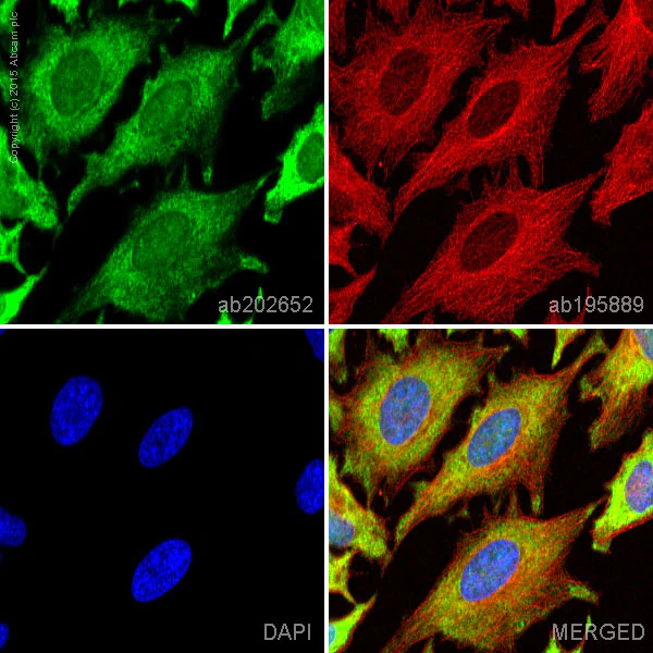 Immunocytochemistry/ Immunofluorescence - Alexa Fluor® 488 Anti-Lactate Dehydrogenase antibody [EP1566Y] (AB202652)