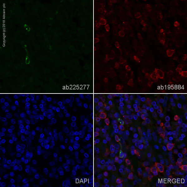 Immunohistochemistry (Formalin/PFA-fixed paraffin-embedded sections) - Alexa Fluor® 488 Anti-LAG-3 antibody [EPR4392(2)] - C-terminal (AB225277)