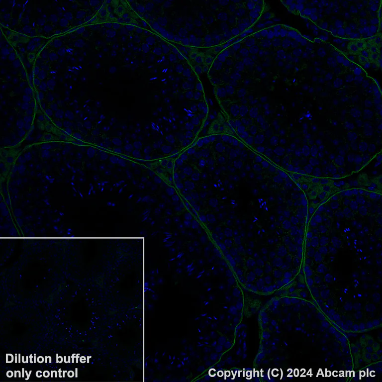 Immunohistochemistry (Formalin/PFA-fixed paraffin-embedded sections) - Alexa Fluor® 488 Anti-LAMA1 antibody [EPR27258-37] (AB317065)
