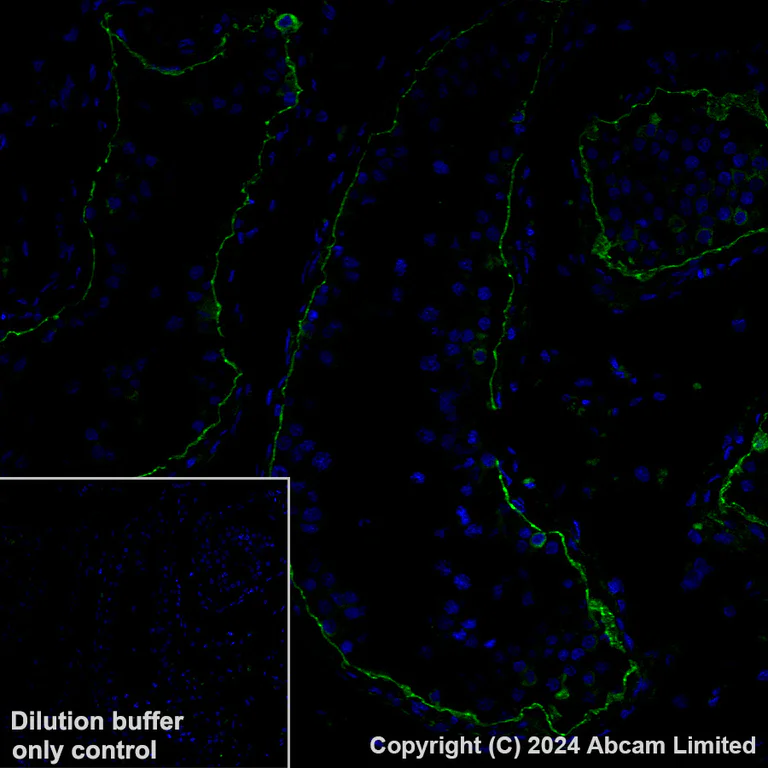 Immunohistochemistry (Formalin/PFA-fixed paraffin-embedded sections) - Alexa Fluor® 488 Anti-LAMA1 antibody [EPR27259-172] (AB320119)