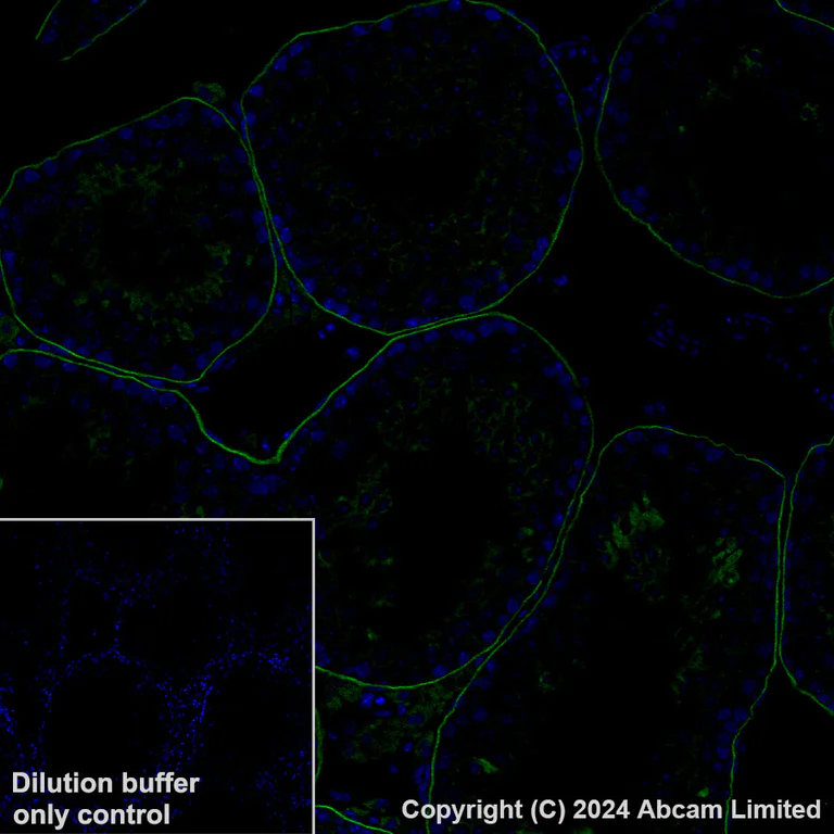 Immunohistochemistry (Formalin/PFA-fixed paraffin-embedded sections) - Alexa Fluor® 488 Anti-LAMA1 antibody [EPR27259-172] (AB320119)