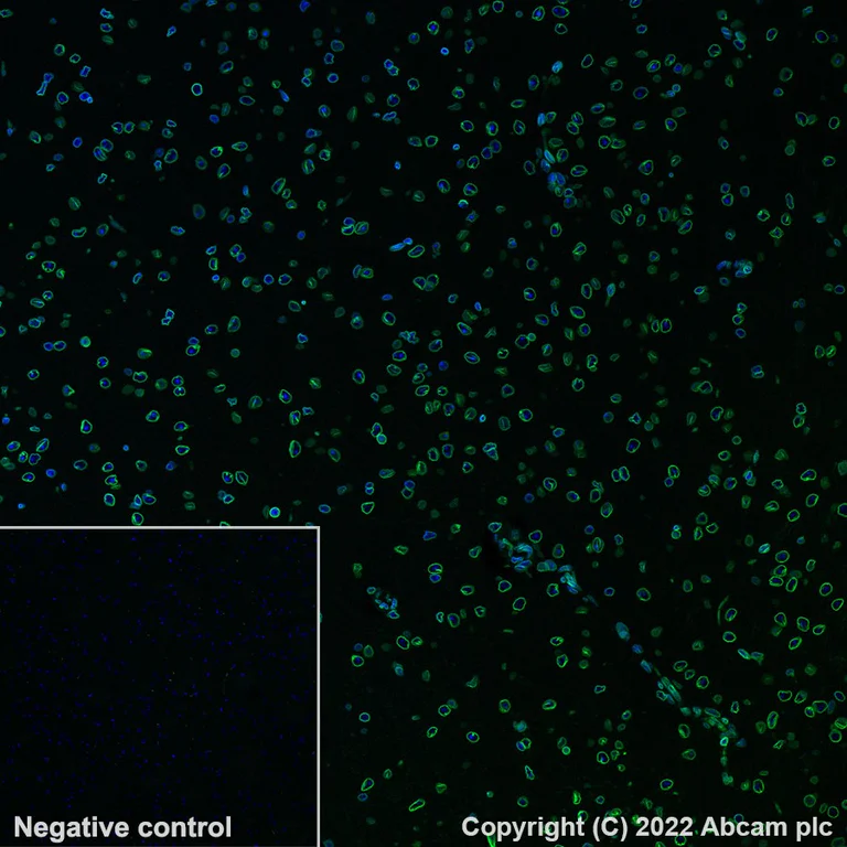 Immunohistochemistry (Formalin/PFA-fixed paraffin-embedded sections) - Alexa Fluor® 488 Anti-Lamin B1 antibody [EPR8985(B)] - Nuclear Envelope Marker (AB194106)