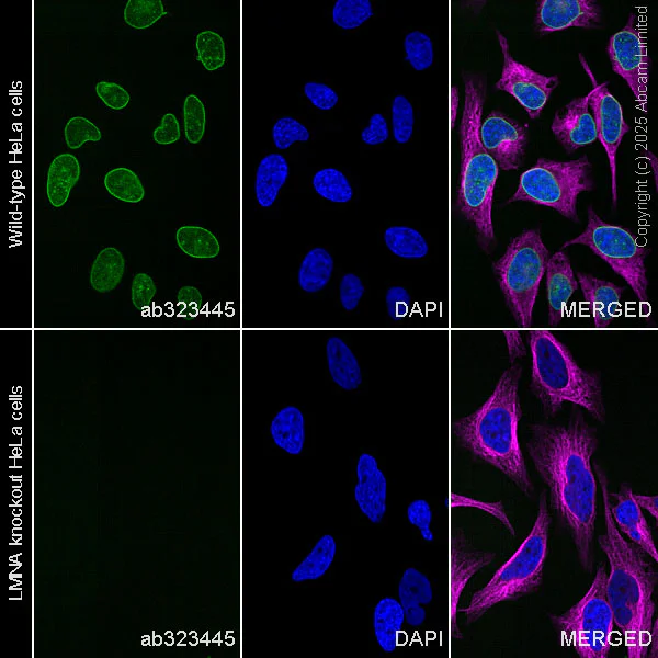Immunocytochemistry/ Immunofluorescence - Alexa Fluor® 488 Anti-Lamin C antibody [EPR28295-16] (AB323445)