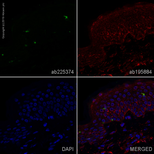 Immunohistochemistry (Formalin/PFA-fixed paraffin-embedded sections) - Alexa Fluor® 488 Anti-Langerin antibody [EPR15863] (AB225374), expandable thumbnail